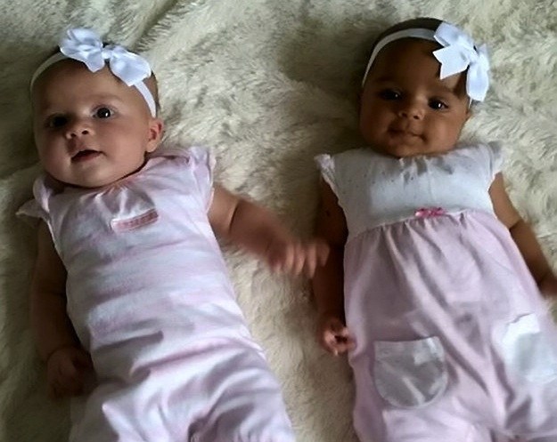 British Gives Birth Twins With Different Skin Colors